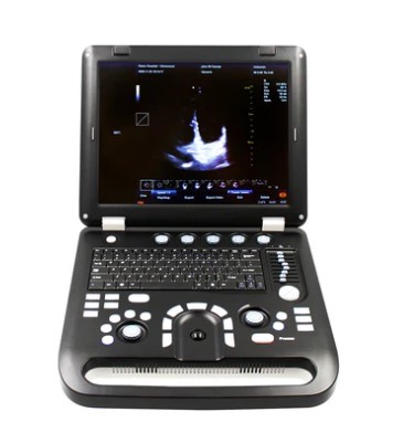 Ultraschallgerät CF TDI CMS1700C Standard